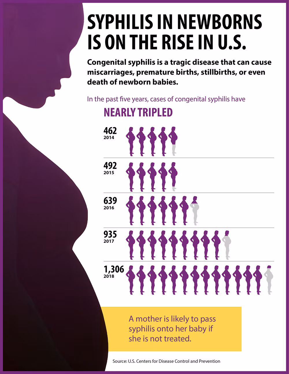 Unlimited CDC Syph FINALav infoGraphics Syphilis in newborns is on the rise in the US