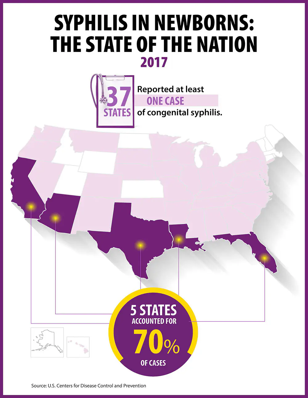 CS-nation_508 SYPHILIS IN NEWBORNS: THE STATE OF THE NATION2017