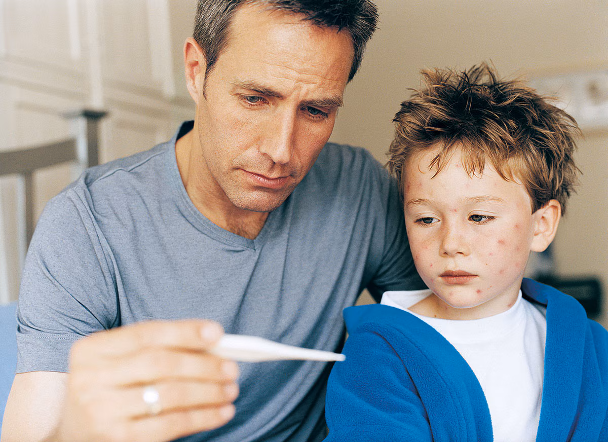 Chickenpox Young Boy A young boy with a chickenpox rash looking at a thermometer with an adult