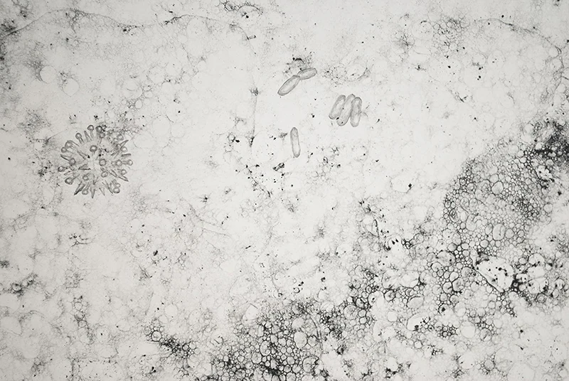 Surface Tension 19