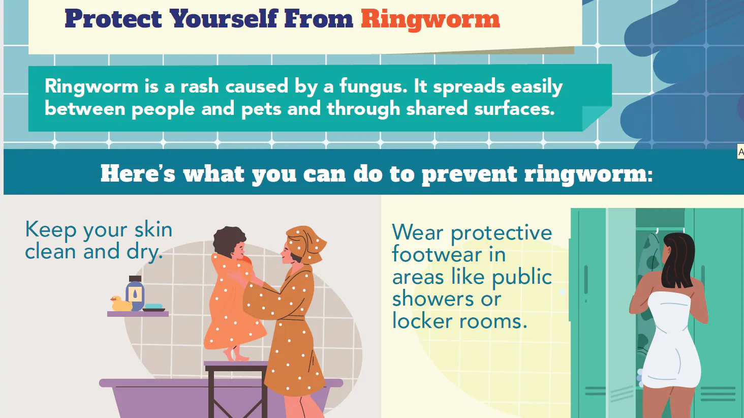 How to prevent ringworm