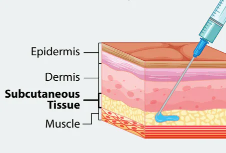 Vaccine Administration: Subcutaneous (SUBCUT) Injection