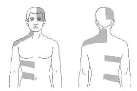 Illustration of shingles.